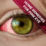 Logo of Home Remedies For Pink Eye - Conjunctivitis android Application 